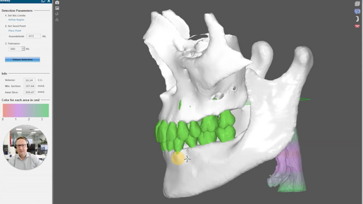 DSD ORTHO PLANNING VS TPS LEARNING HUB THUMBNAIL IMAGE
