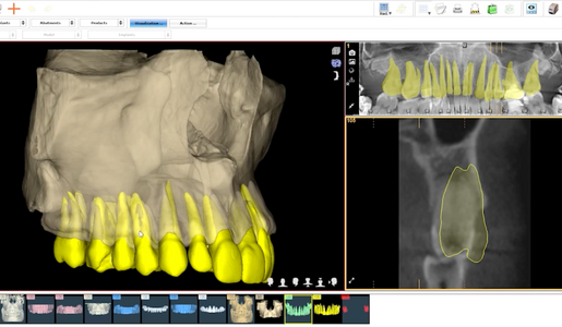WHAT IS THE DSD ORTHO PLANNING LEARNING HUB ARTICLE IMAGE