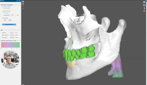 ORTHO PLANNING VS TPS LEARNING HUB ARTICLE IMAGE