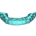 Bite Splint 1