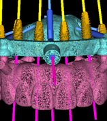 DSD Clic Guide Design