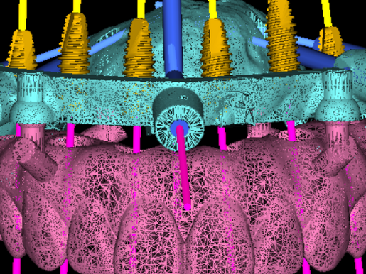 DSD Clic Guide Design