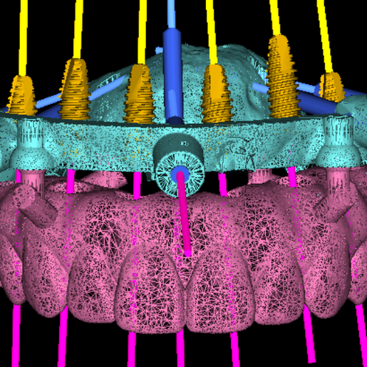 DSD Clic Guide Design