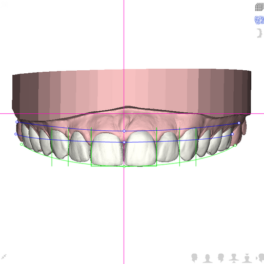 DSD Upper