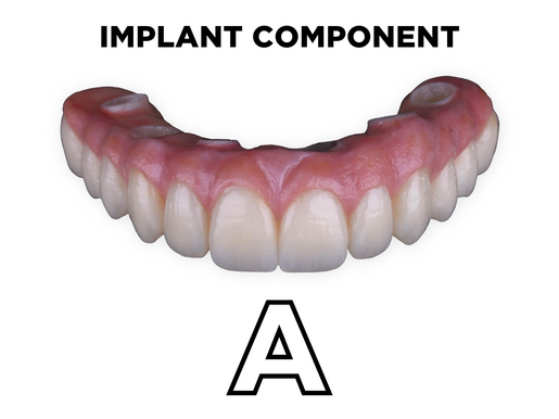 Full Arch Implant Bridge Manufacture