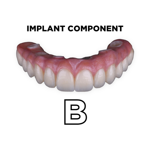 Full Arch Implant Bridge Manufacture B