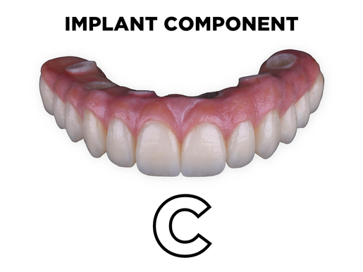 Full Arch Implant Bridge Manufacture C