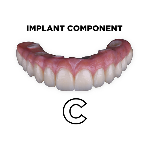 Full Arch Implant Bridge Manufacture C