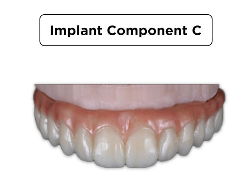 Implant Component Implant Component C
