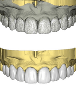 DSD Natural Restoration Design per unit