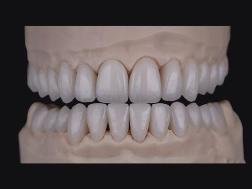 1 DSD Natural Restorations Manufacture PER UNIT