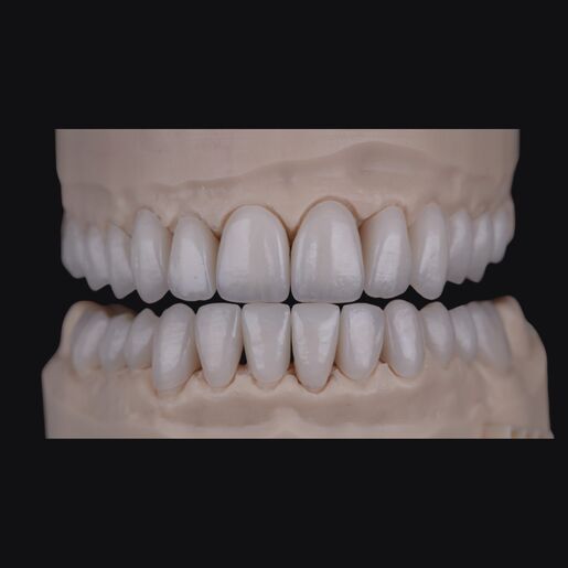 1 DSD Natural Restorations Manufacture PER UNIT