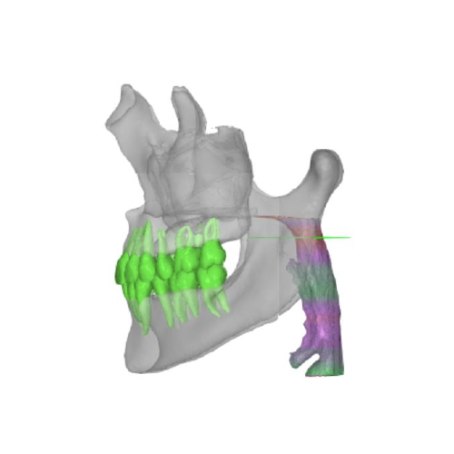 4 AIRWAY ANALYSIS