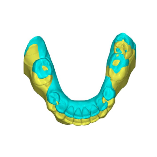 7 ORTHOGNATIC SURGERY