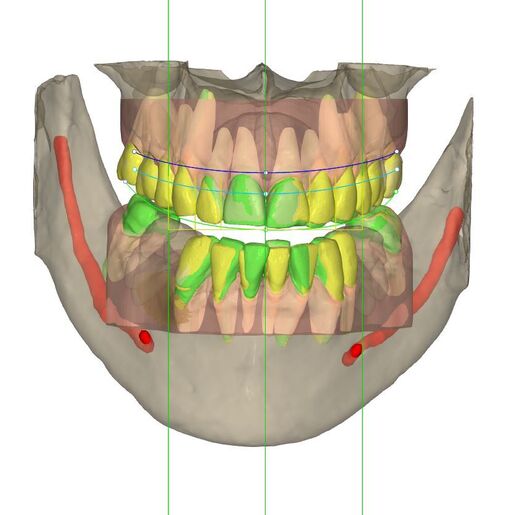 5 ORTHO SIMULATION