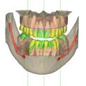 5 ORTHO SIMULATION
