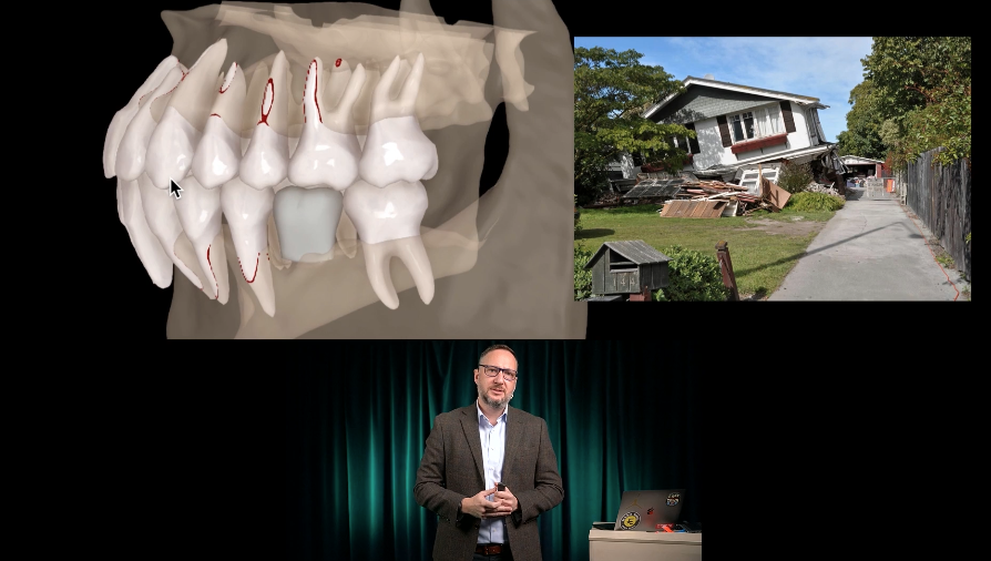 DSD Aligners preview class — building a house analogy