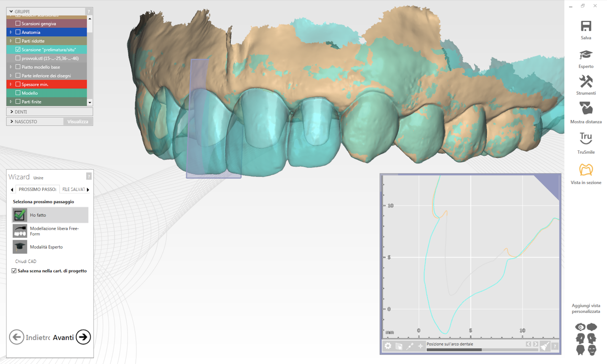 Dental lab technician working with digital files and intraoral scan data