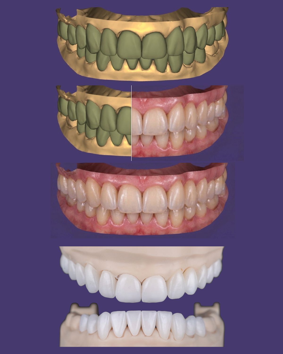 A dentist reviewing and approving a digital restoration design on a phone