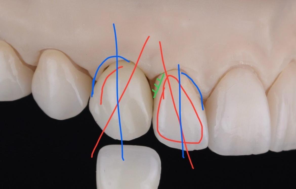 A lab technician and dentist in a visual feedback conversation during an asynchronous review
