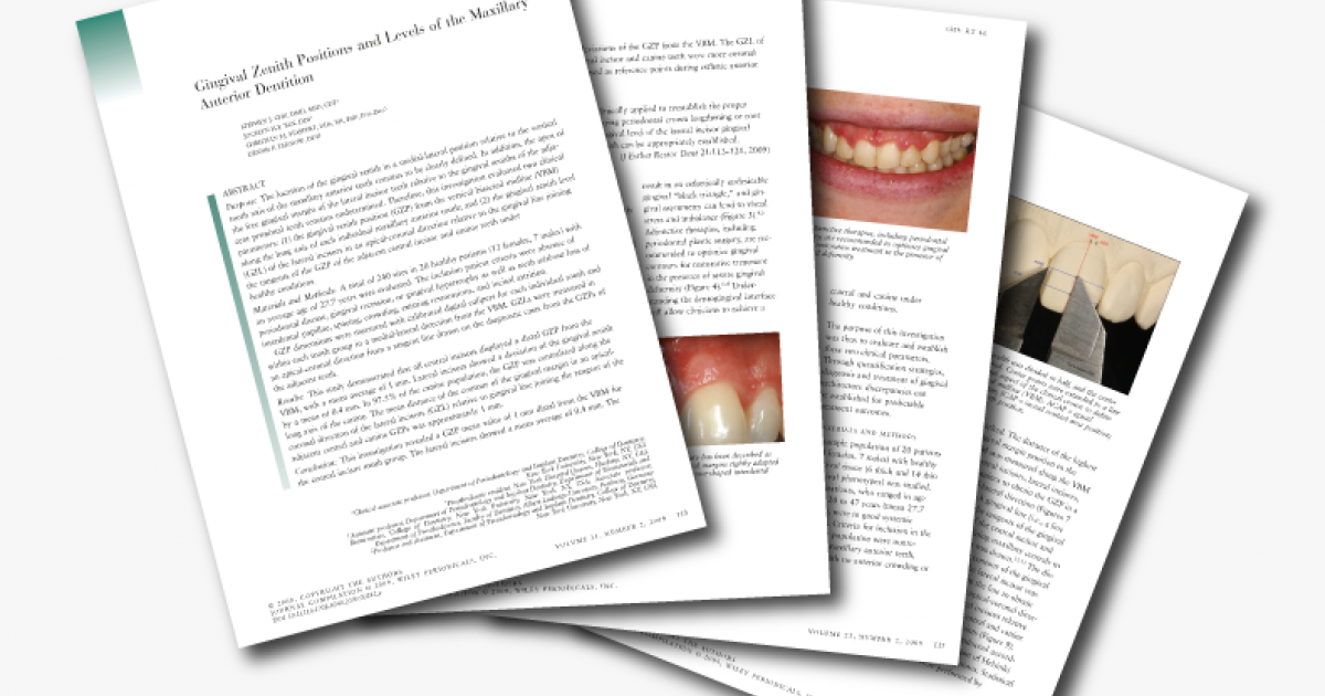 Gingival Zenith Positions And Levels Of The Maxillary Anterior